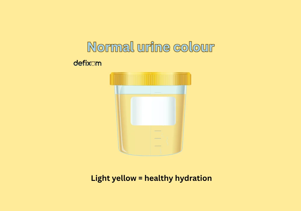 normal urine colour